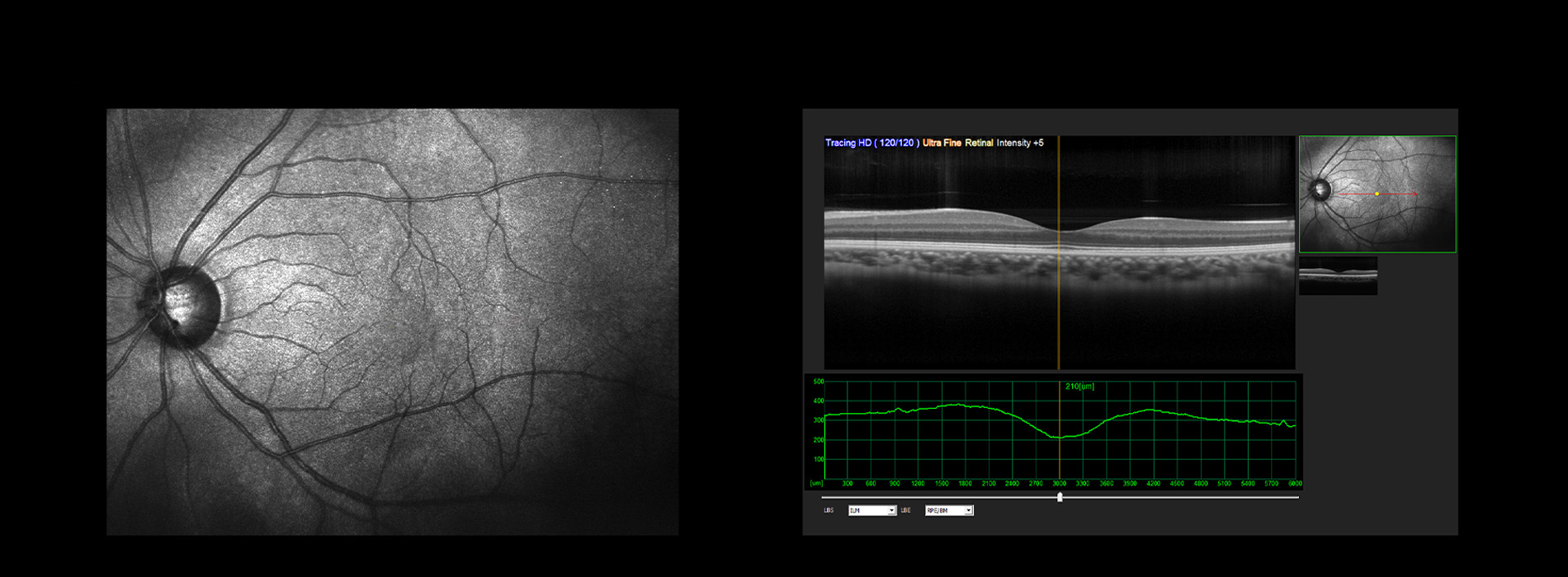 The image shows a collage of medical images, including an MRI scan, an ultrasound, and a retinal examination, displayed on a computer screen with accompanying text, presumably for educational or diagnostic purposes.