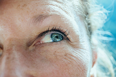The image shows a close-up of a person s face with visible skin imperfections, looking towards the camera with their eyes focused on something off-frame, likely taken from another angle due to the distortion effect.